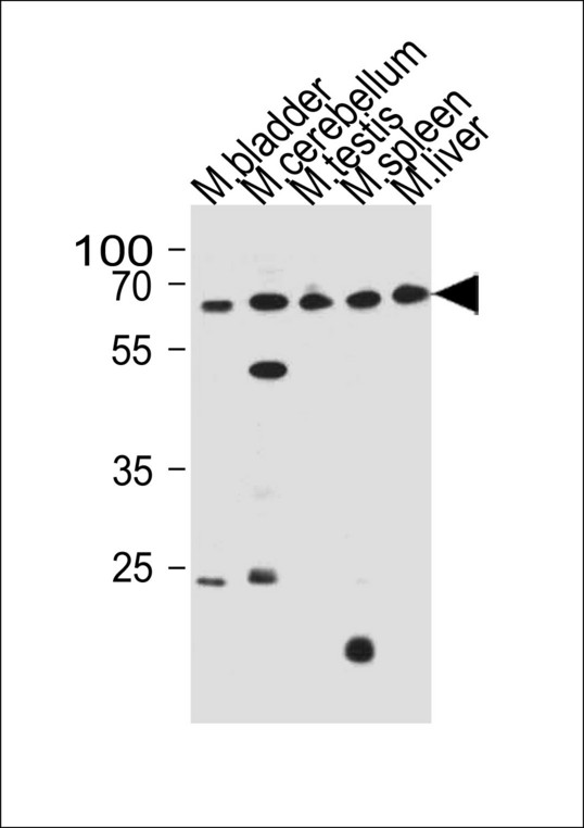 ZNF654 Antibody western blot of mouse bladder,cerebellum,testis,spleen and liver tissue lysates (35 ug/lane). The ZNF654 antibody detected the ZNF654 protein (arrow).