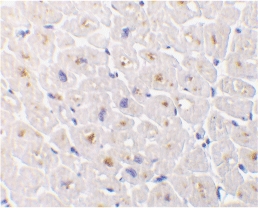 Immunohistochemistry of DcR1 in human heart tissue with DcR1 antibody at 1 µg/ml.