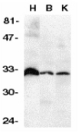 Western blot of DcR3 in human heart (H), brain (B), and kidney (K) tissue lysates with DcR3 antibody at 1 ug/ml.