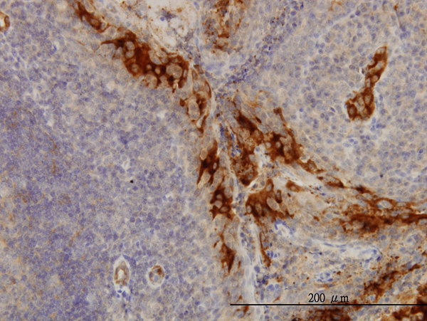 Immunoperoxidase of monoclonal antibody to TNFRSF6B on formalin-fixed paraffin-embedded human tonsil. [antibody concentration 3 ug/ml]