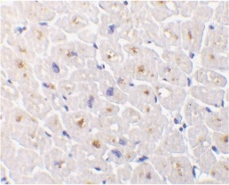 Immunohistochemistry of human heart with Rabbit anti-Human DcR3