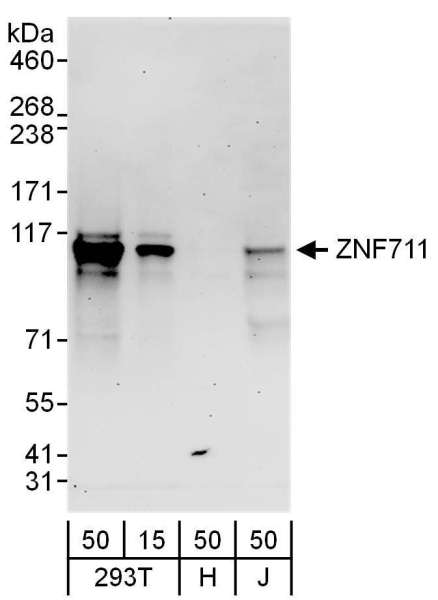 Detection of Human ZNF711 by Western Blot. Samples: Whole cell lysate from 293T (15 and 50 ug), HeLa (H; 50 ug) and Jurkat (J; 50 ug) cells. Antibodies: Affinity purified rabbit anti-ZNF711 antibody used for WB at 0.1 ug/ml. Detection: Chemiluminescence with an exposure time of 3 minutes.