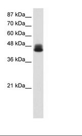 Transfected 293T Cell Lysate