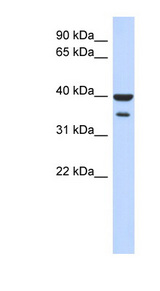 ZNF785 antibody LS-C110454 Western blot of Fetal Pancreas lysate.