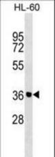 ZNF785 Antibody western blot of HL-60 cell line lysates (35 ug/lane). The ZNF785 antibody detected the ZNF785 protein (arrow).