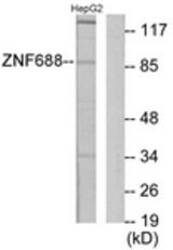 Western blot of extracts from HepG2 cells, using ZNF785 Antibody. The lane on the right is treated with the synthesized peptide.