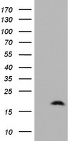 HEK293T cells were transfected with the pCMV6-ENTRY control (Left lane) or pCMV6-ENTRY ZNRD1 (Right lane) cDNA for 48 hrs and lysed. Equivalent amounts of cell lysates (5 ug per lane) were separated by SDS-PAGE and immunoblotted with anti-ZNRD1.