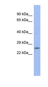 ZNRF1 antibody LS-C110427 Western blot of Fetal Spleen lysate.