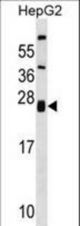 ZNRF1 Antibody western blot of HepG2 cell line lysates (35 ug/lane). The ZNRF1 antibody detected the ZNRF1 protein (arrow).