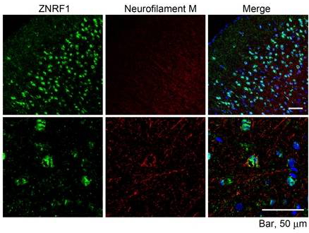 ZNRF1 antibody (10 ug/ml) staining of paraffin embedded Mouse Cerebral Cortex. Microwaved antigen retrieval with citrate buffer pH 6, Streptavidin-Alexa 488-staining after biotinylated anti-goat secondary. The Neurofilament M was labeled by Millipore AB1987 (1:100).