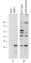 ZNRF1 antibody N2a overexpressing Mouse Znrf1 (mock transfection in first lane) and probed with (1 ug/ml), also staining of Mouse Brain lysates (Embryo E14 and adult cerebellum). Primary incubation was 1 hour. Detected by chemiluminescence.