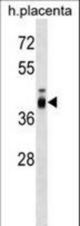ZP3 Antibody western blot of human placenta tissue lysates (35 ug/lane). The ZP3 antibody detected the ZP3 protein (arrow).