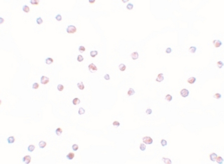 Immunocytochemistry of TRIP6 in HeLa cells with TRIP6 antibody.