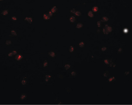 Immunofluorescence of TRIP6 in HeLa cells with TRIP6 antibody at 20 ug/ml.