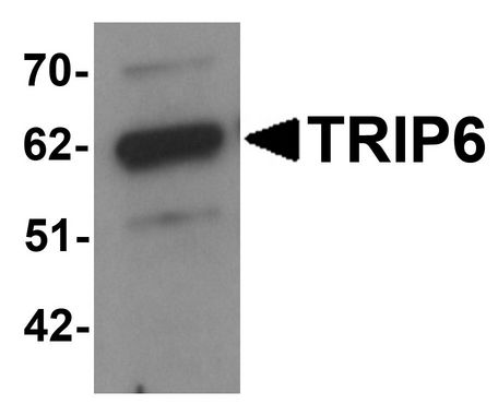 Western blot analysis of TRIP6 in EL4 cell lysate with TRIP6 antibody at 1 ug/ml.