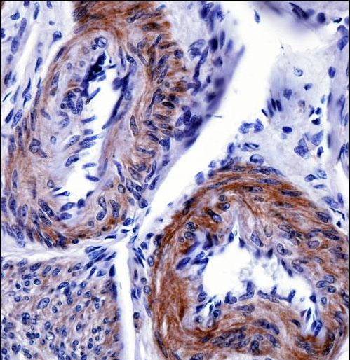 TRIP6 Antibody immunohistochemistry of formalin-fixed and paraffin-embedded human uterus tissue followed by peroxidase-conjugated secondary antibody and DAB staining.