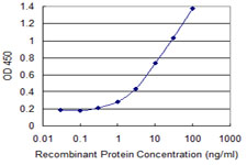 Detection limit for recombinant GST tagged ZRSR2 is 0.1 ng/ml as a capture antibody.