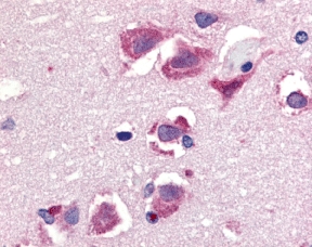 Immunohistochemistry of TRAIL in human brain tissue with TRAIL antibody at 20 µg/ml.