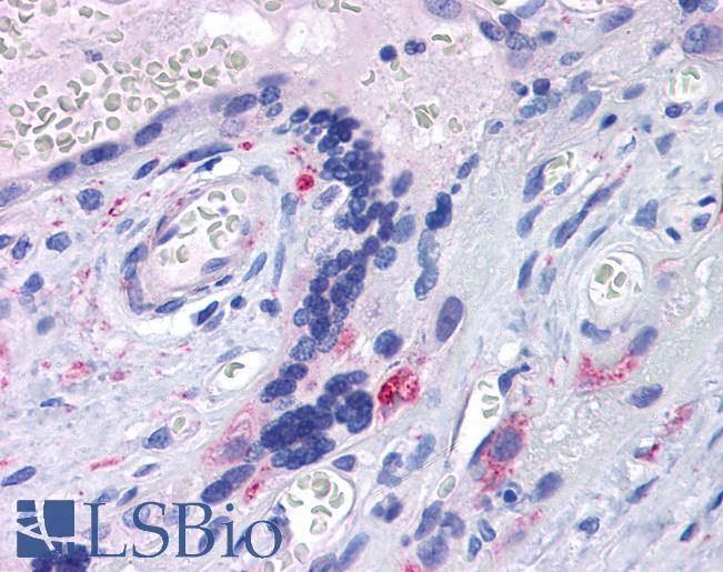 Anti-TLR7 antibody IHC of human placenta. Immunohistochemistry of formalin-fixed, paraffin-embedded tissue after heat-induced antigen retrieval. Antibody LS-B4828 concentration 10 ug/ml.