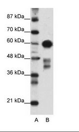 A: Marker, B: Transfected 293T Cell Lysate
