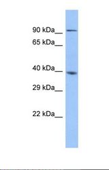 Western blot of Human Fetal Liver. ZSCAN5A antibody dilution 1.0 ug/ml.