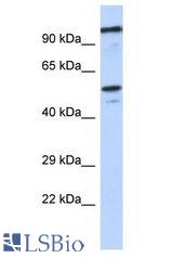 ZSCAN5 / ZSCAN5A antibody Western Blot of SH-SYSY. Antibody dilution: 1 ug/ml.