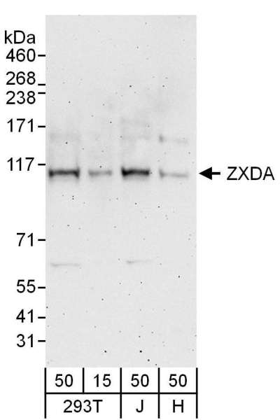 Detection of Human ZXDA by Western Blot. Samples: Whole cell lysate from 293T(15 and 50 ug), Jurkat (J; 50 ug) and HeLa (H; 50 ug) cells. Antibodies: Affinity purified rabbit anti-ZXDA antibody used for WB at 0.4 ug/ml. Detection: Chemiluminescence with an exposure time of 3 minutes.