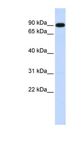 ZXDA antibody LS-C101716 Western blot of Fetal Muscle lysate.