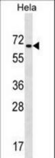 ZNF35 Antibody western blot of HeLa cell line lysates (35 ug/lane). The ZNF35 antibody detected the ZNF35 protein (arrow).