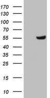 HEK293T cells were transfected with the pCMV6-ENTRY control (Left lane) or pCMV6-ENTRY ZNF35 (Right lane) cDNA for 48 hrs and lysed. Equivalent amounts of cell lysates (5 ug per lane) were separated by SDS-PAGE and immunoblotted with anti-ZNF35.