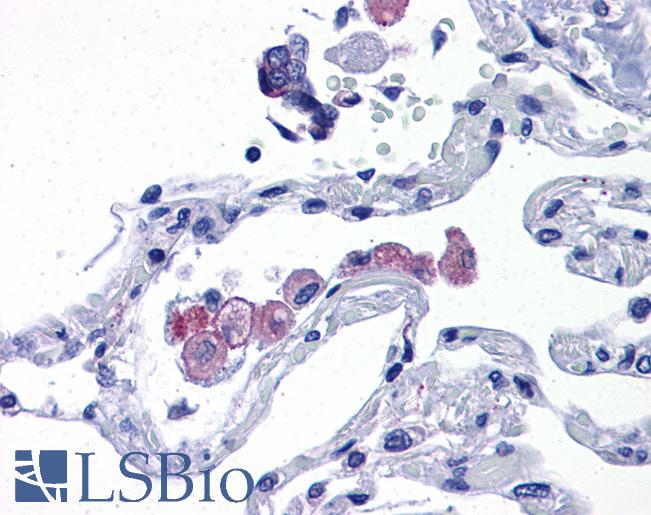 Anti-TLR7 antibody IHC of human lung. Immunohistochemistry of formalin-fixed, paraffin-embedded tissue after heat-induced antigen retrieval. Antibody LS-B4828 concentration 10 ug/ml.