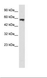 Jurkat Cell Lysate