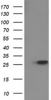 HEK293T cells were transfected with the pCMV6-ENTRY control (Left lane) or pCMV6-ENTRY HPGD (Right lane) cDNA for 48 hrs and lysed. Equivalent amounts of cell lysates (5 ug per lane) were separated by SDS-PAGE and immunoblotted with anti-HPGD.