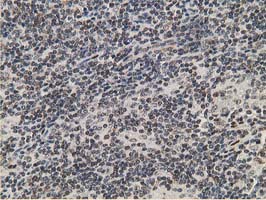 IHC of paraffin-embedded Human lymphoma tissue using anti-HPGD mouse monoclonal antibody. (Heat-induced epitope retrieval by 10mM citric buffer, pH6.0, 100C for 10min).