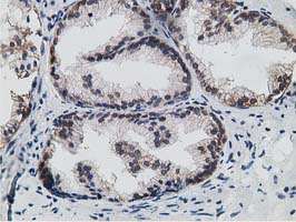 IHC of paraffin-embedded Human prostate tissue using anti-HPGD mouse monoclonal antibody. (Heat-induced epitope retrieval by 10mM citric buffer, pH6.0, 100C for 10min).