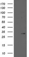 HEK293T cells were transfected with the pCMV6-ENTRY control (Left lane) or pCMV6-ENTRY HPGD (Right lane) cDNA for 48 hrs and lysed. Equivalent amounts of cell lysates (5 ug per lane) were separated by SDS-PAGE and immunoblotted with anti-HPGD.
