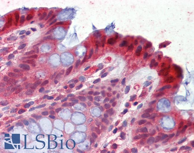 Anti-HPGD / 15-PGDH antibody IHC of human colon. Immunohistochemistry of formalin-fixed, paraffin-embedded tissue after heat-induced antigen retrieval. Antibody LS-B3599 concentration 2.5 ug/ml.