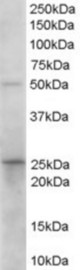 (0.1 ug/ml) staining of Human Duodenum lysate (35 ug protein in RIPA buffer). Primary incubation was 1 hour. Detected by chemiluminescence.