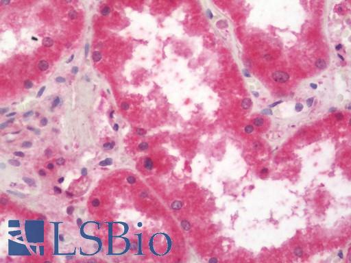 Human Kidney: Formalin-Fixed, Paraffin-Embedded (FFPE)