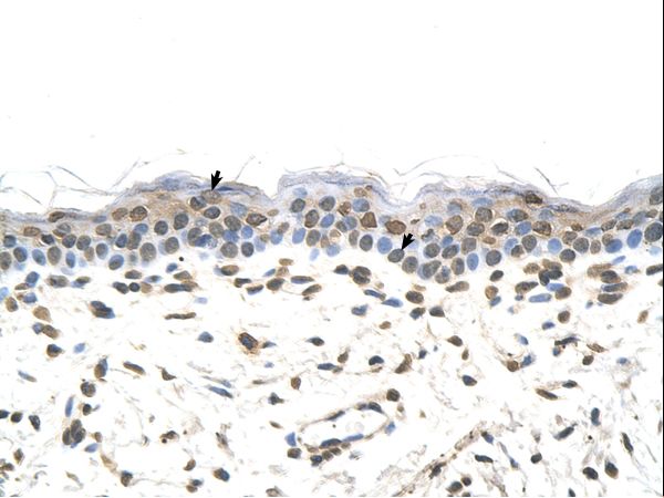 FTCD antibody LS-C80438 was used in IHC to stain formalin-fixed, paraffin-embedded human skin.