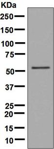Western blot analysis on fetal liver lysate using anti-FTCD antibody.
