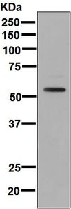Western blot analysis on fetal liver lysate using anti-FTCD antibody.