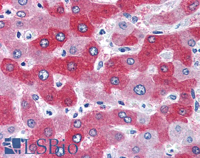 Anti-FTCD antibody IHC of human liver. Immunohistochemistry of formalin-fixed, paraffin-embedded tissue after heat-induced antigen retrieval. Antibody LS-B2755 concentration 75 ug/ml.