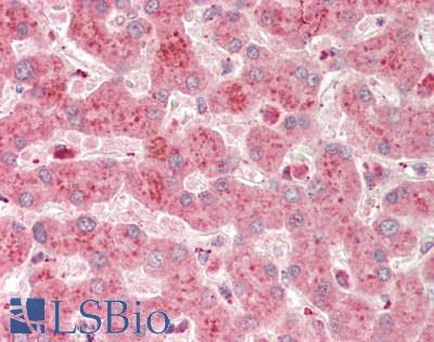 Human Liver: Formalin-Fixed, Paraffin-Embedded (FFPE)