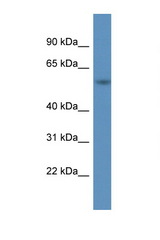 A1BG antibody western blot of HT1080 Cell lysate. Antibody concentration 1 ug/ml.