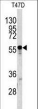 Western blot of A1BG antibody in T47D cell line lysates (35 ug/lane). A1BG (arrow) was detected using the purified antibody.