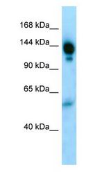Alpha-2-Macroglobulin / A2M antibody Western Blot of Human skin.