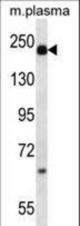 A2M Antibody western blot of mouse plasma lysates (35 ug/lane). The A2M antibody detected the A2M protein (arrow).