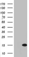 HEK293T cells were transfected with the pCMV6-ENTRY control (Left lane) or pCMV6-ENTRY C11orf67 (Right lane) cDNA for 48 hrs and lysed. Equivalent amounts of cell lysates (5 ug per lane) were separated by SDS-PAGE and immunoblotted with anti-C11orf67.