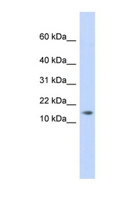 C11orf67 antibody LS-C102627 Western blot of Placenta lysate.